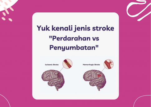 Yuk kenali jenis stroke 